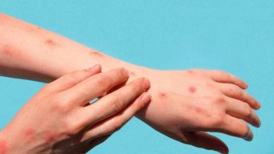 Foto de OMS incorpora vacuna contra viruela del mono a lista de productos que considera seguros y eficaces