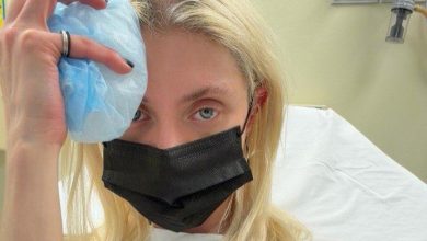 Foto de Taylor Momsen fue mordida por una araña y ahora está hospitalizada