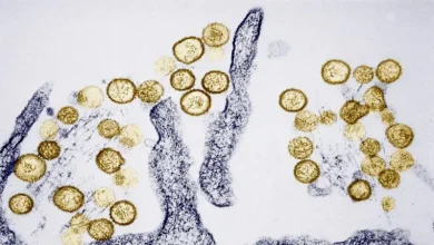 Foto de Hantavirus y cuáles son los síntomas tras la muerte en un crucero en Ushuaia