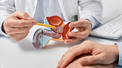 Foto de Cáncer de próstata: cuántos casos se registran cada año, edad de mayor riesgo, posibilidades de curación y medidas