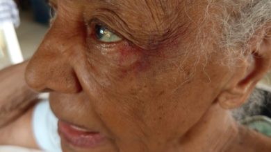 Foto de Brutal agresión contra un adulto mayor de 84 años: Señalan a un niño en acogida