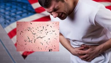 Foto de The New Yorker pide extrema precaución con productos que irritan el intestino delgado